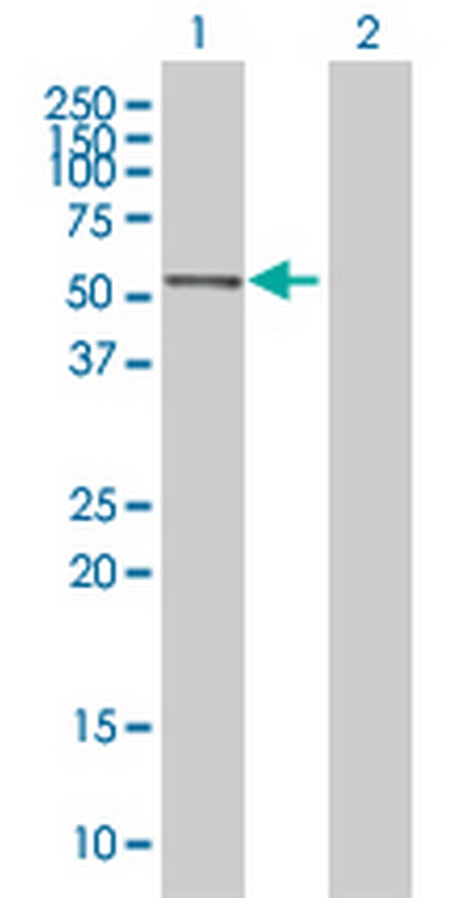 ACTR1A Antibody in Western Blot (WB)