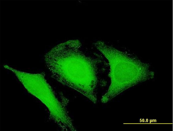 OPTN Antibody in Immunocytochemistry (ICC/IF)