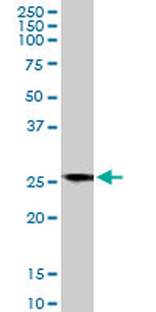 BCAP31 Antibody in Western Blot (WB)