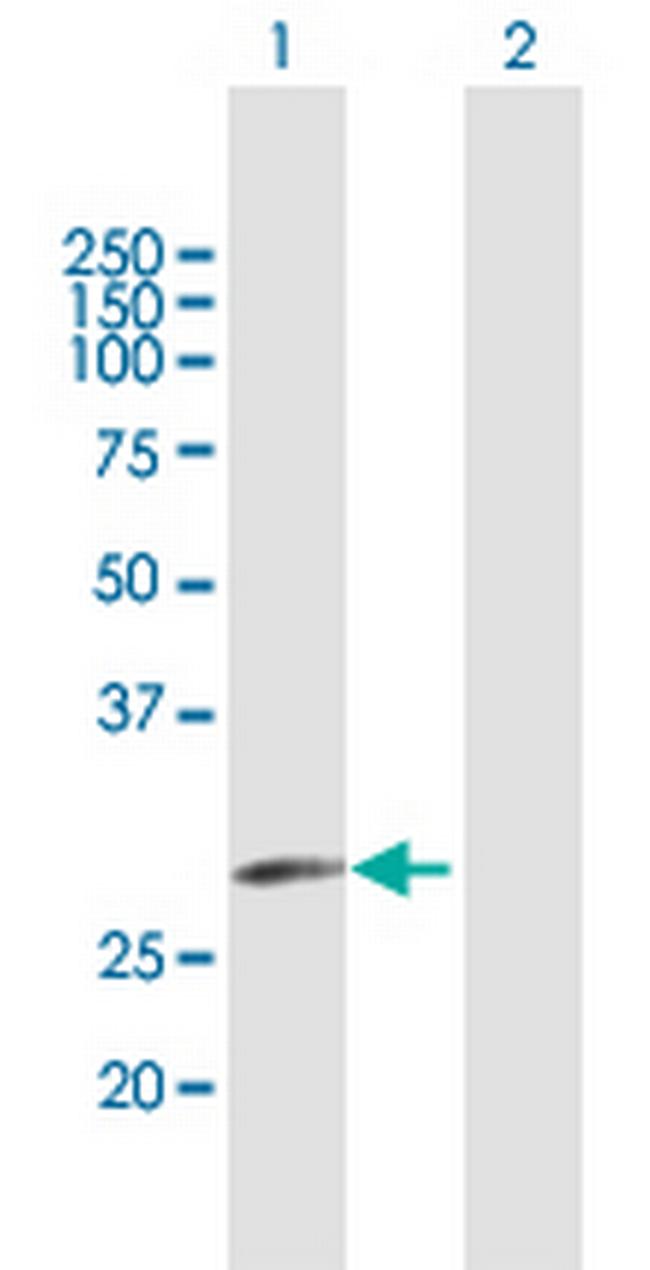 ELA3A Antibody in Western Blot (WB)