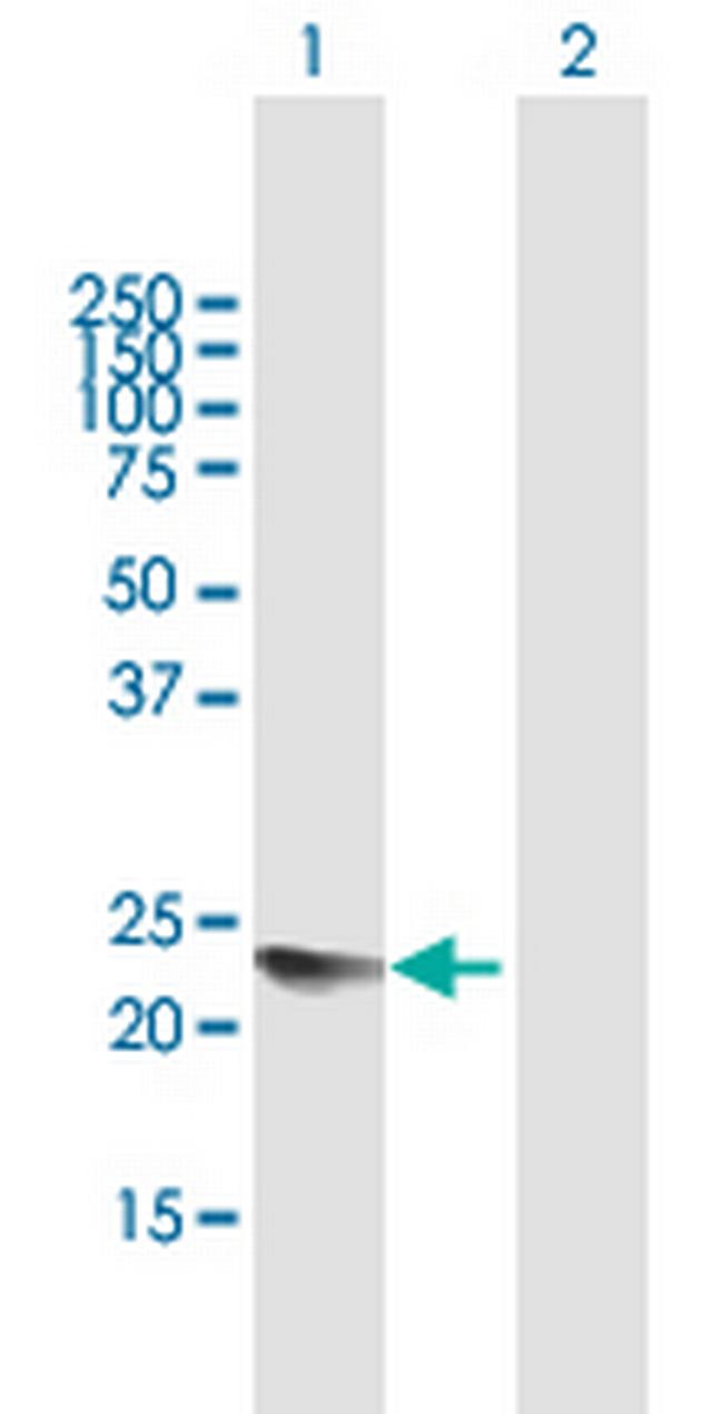 YAF2 Antibody in Western Blot (WB)