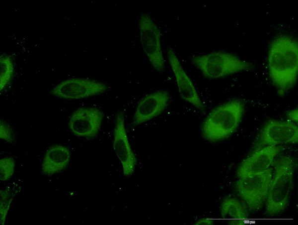 G3BP1 Antibody in Immunocytochemistry (ICC/IF)