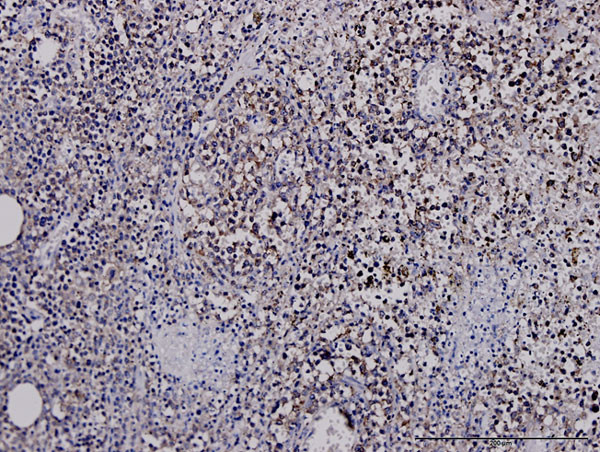 G3BP1 Antibody in Immunohistochemistry (Paraffin) (IHC (P))