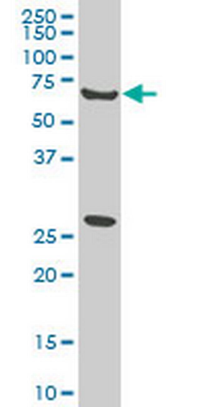 WASF2 Antibody in Western Blot (WB)