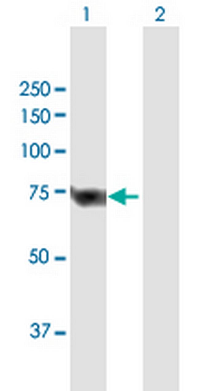 SLC25A13 Antibody in Western Blot (WB)