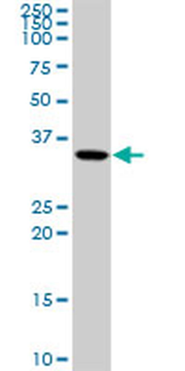 DHRS9 Antibody in Western Blot (WB)