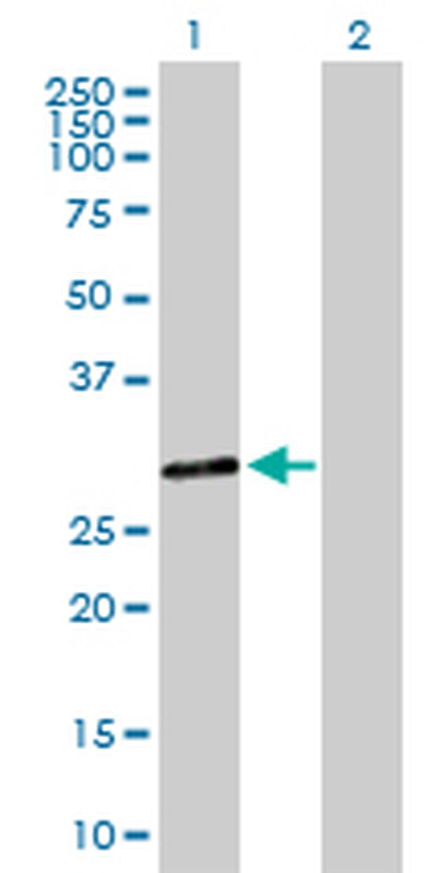 DHRS9 Antibody in Western Blot (WB)