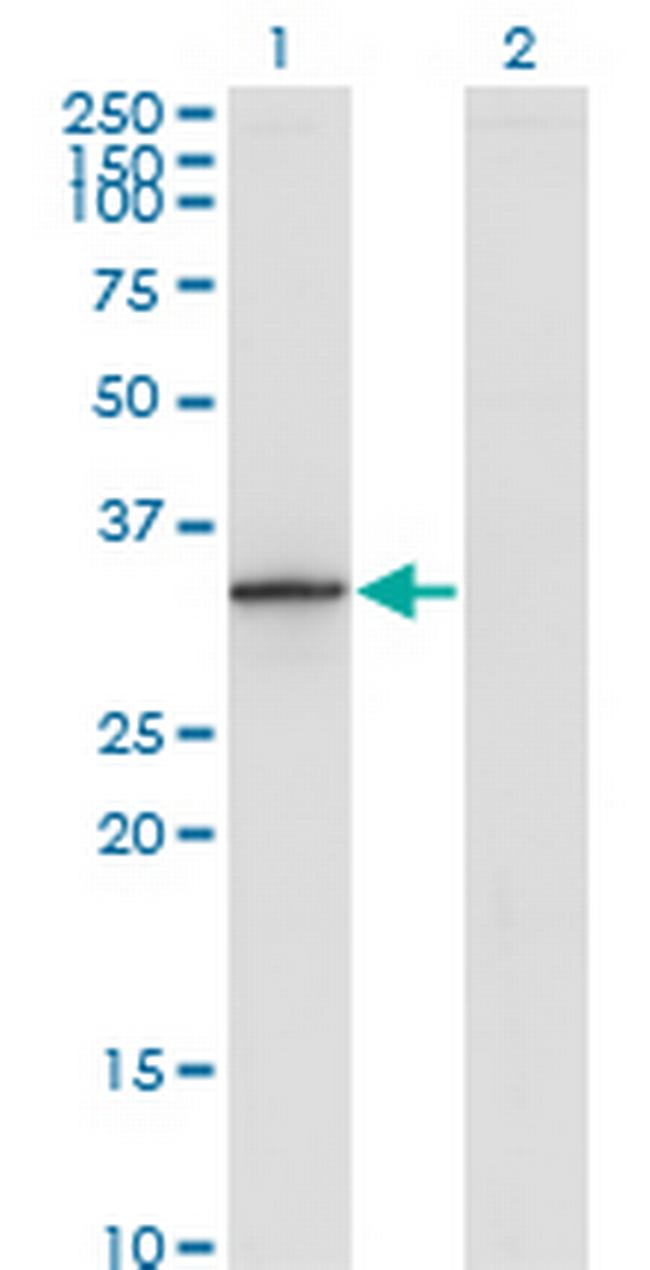 DHRS9 Antibody in Western Blot (WB)