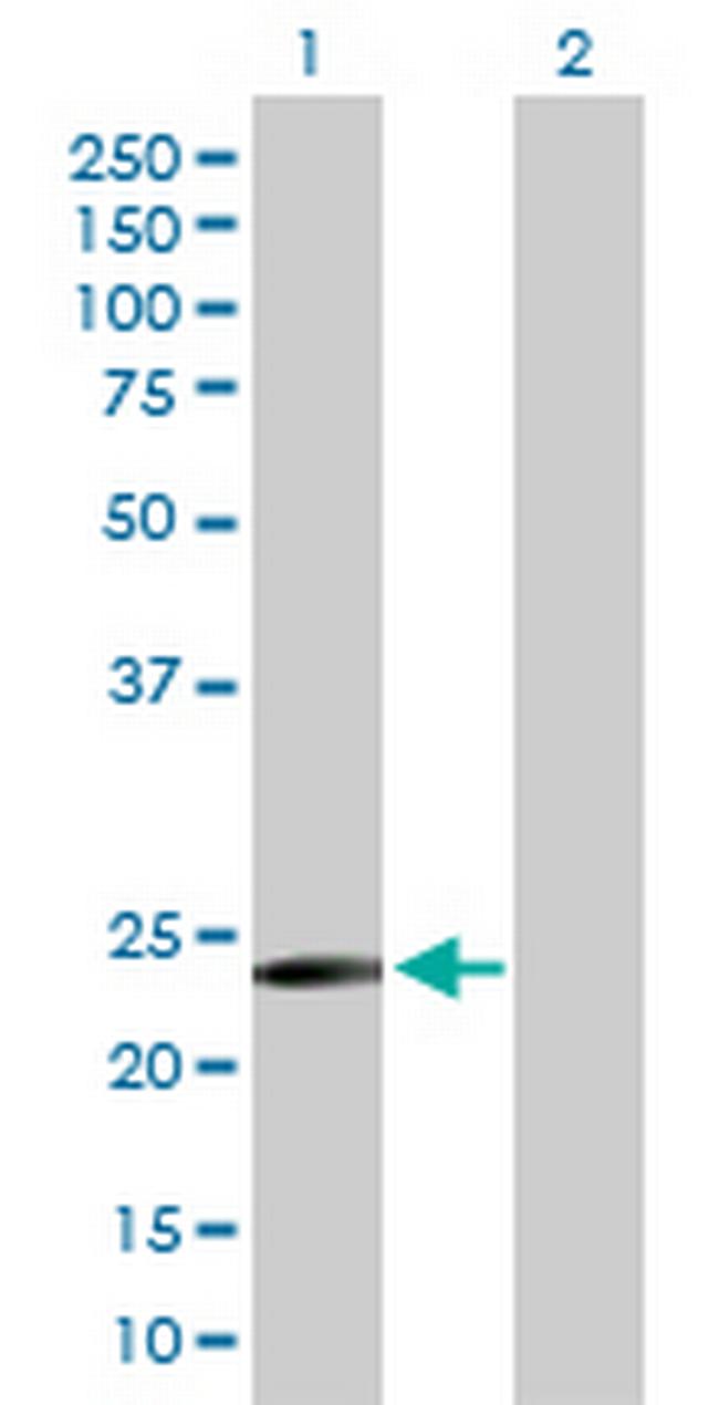 TXNDC9 Antibody in Western Blot (WB)