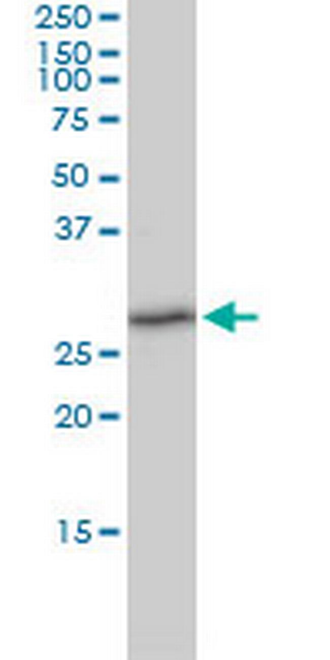 TXNDC9 Antibody in Western Blot (WB)