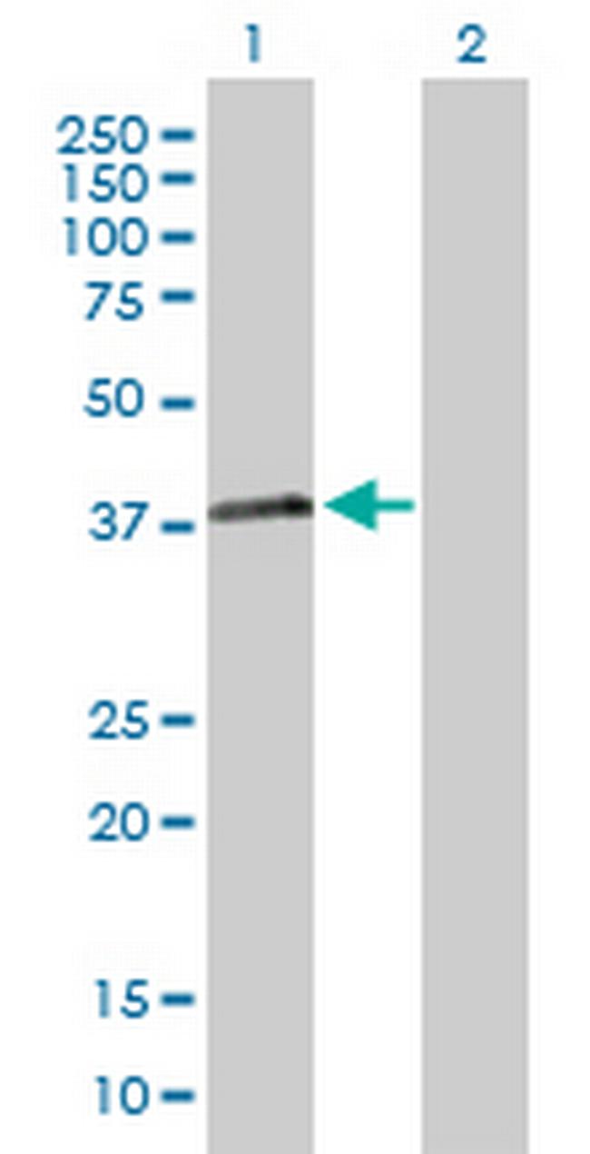 RNF41 Antibody in Western Blot (WB)