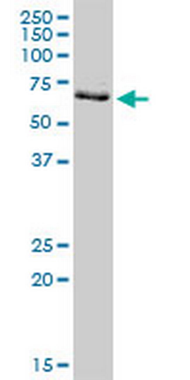 PRMT3 Antibody in Western Blot (WB)