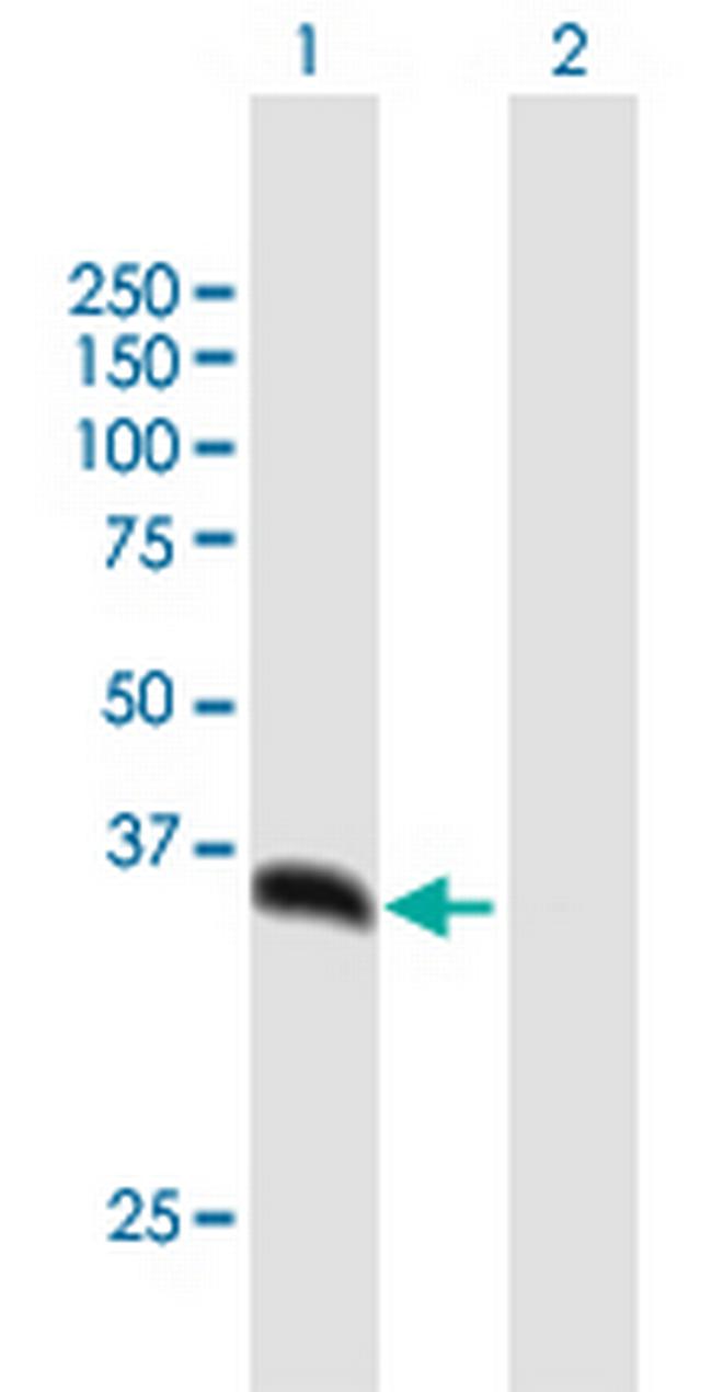 PSMD14 Antibody in Western Blot (WB)