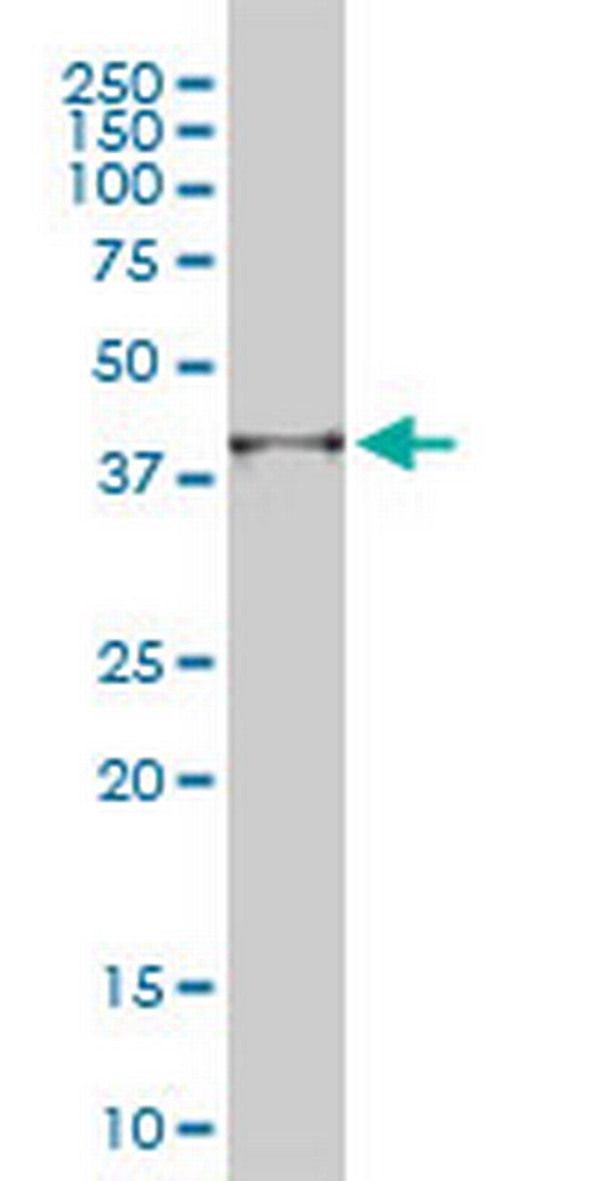 PSMD14 Antibody in Western Blot (WB)