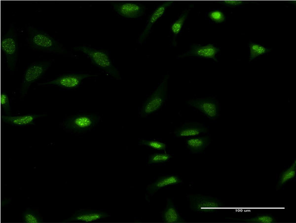 OLIG2 Antibody in Immunocytochemistry (ICC/IF)