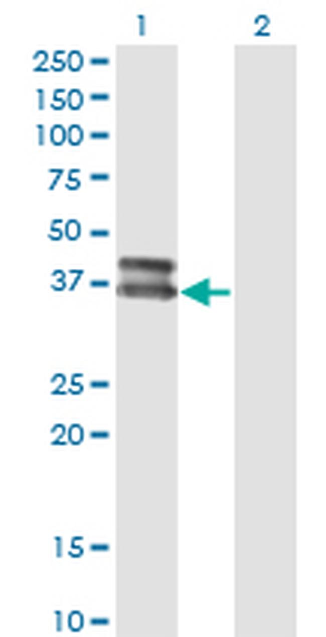 OLIG2 Antibody in Western Blot (WB)