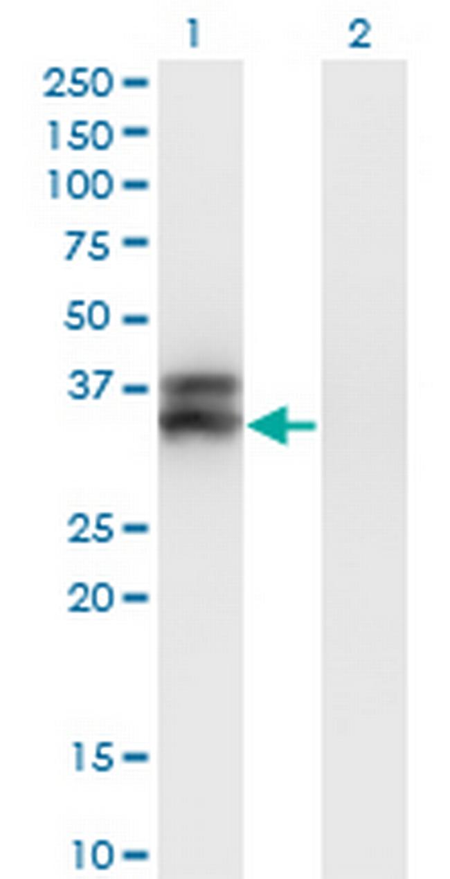 OLIG2 Antibody in Western Blot (WB)