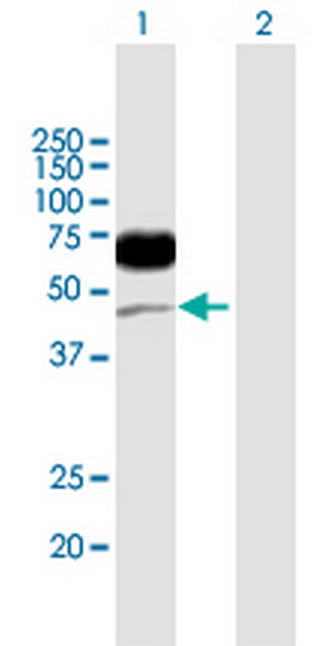 CD96 Antibody in Western Blot (WB)