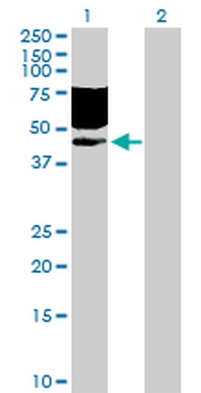 CD96 Antibody in Western Blot (WB)