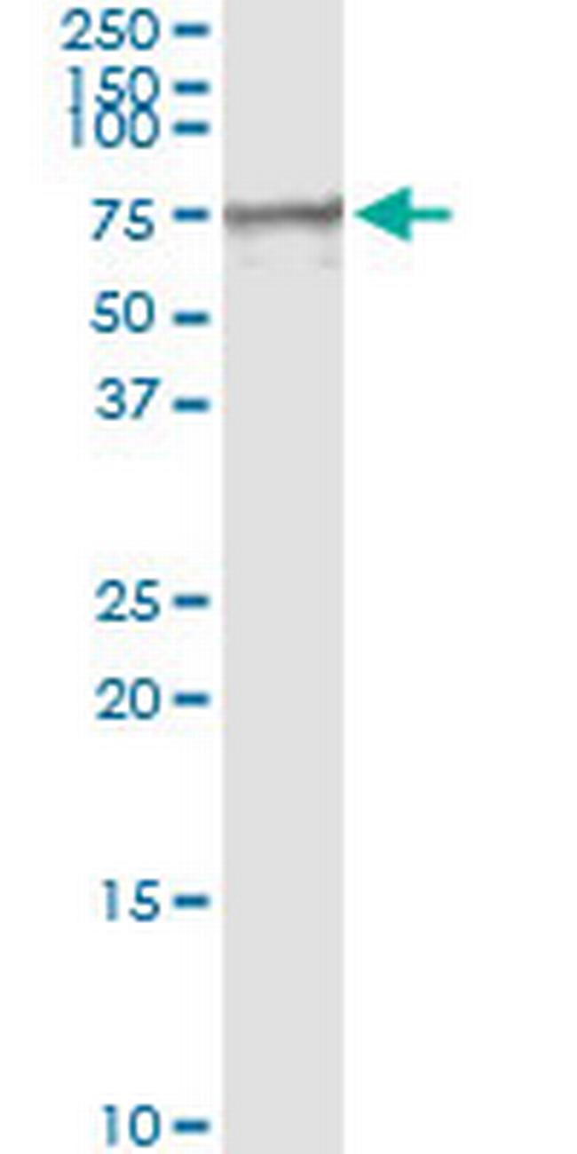 MSLN Antibody in Immunoprecipitation (IP)