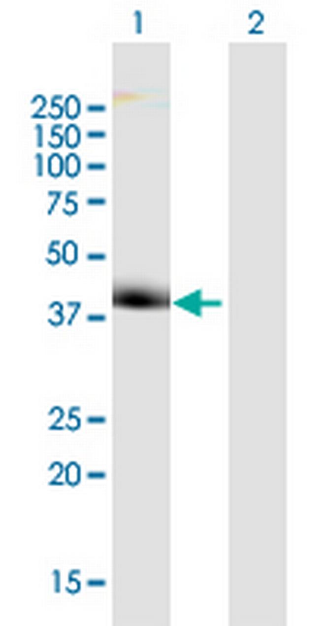 WDR68 Antibody in Western Blot (WB)