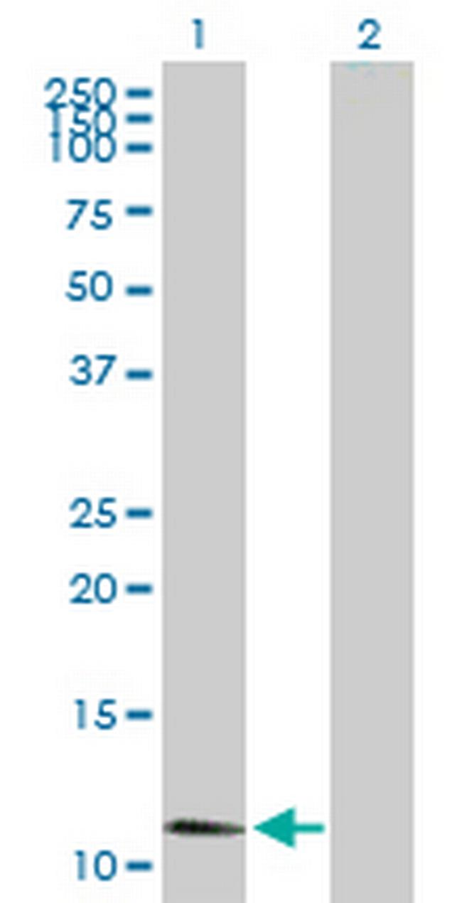 HRSP12 Antibody in Western Blot (WB)