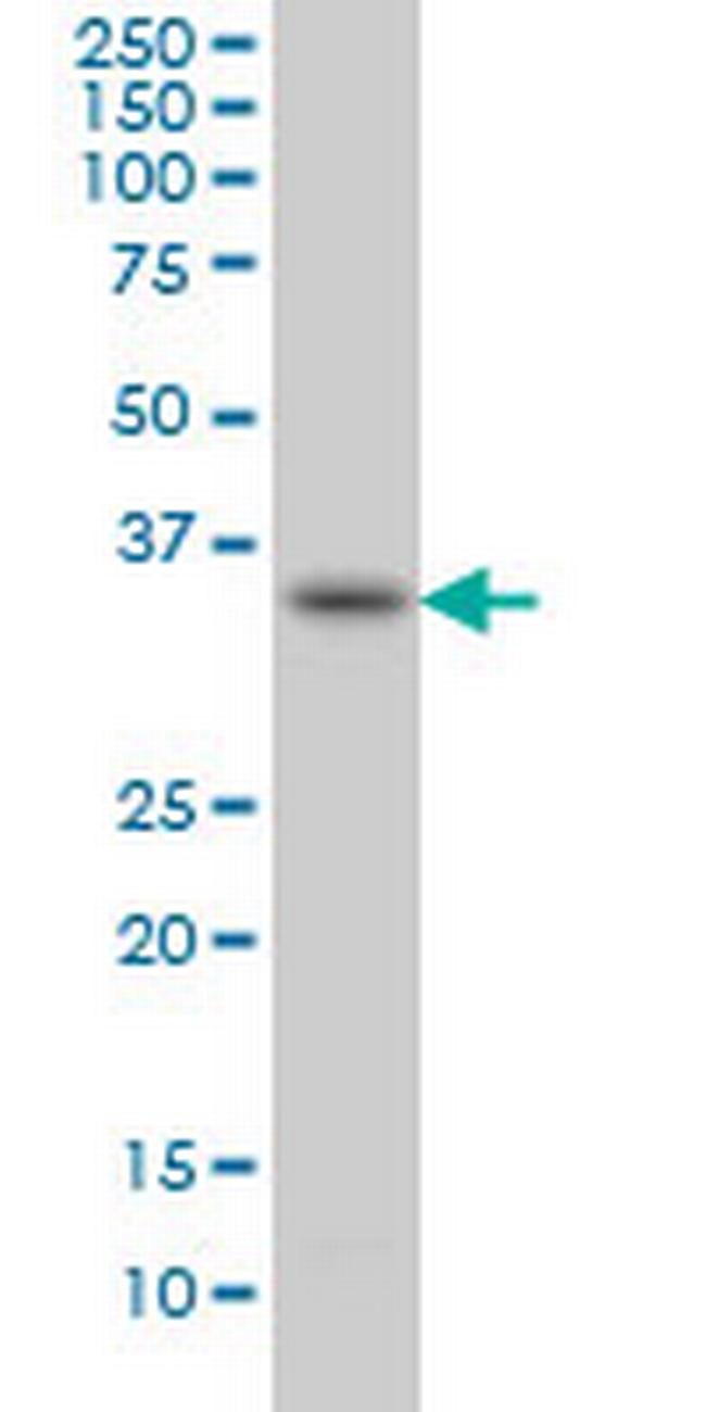 SPRY1 Antibody in Western Blot (WB)