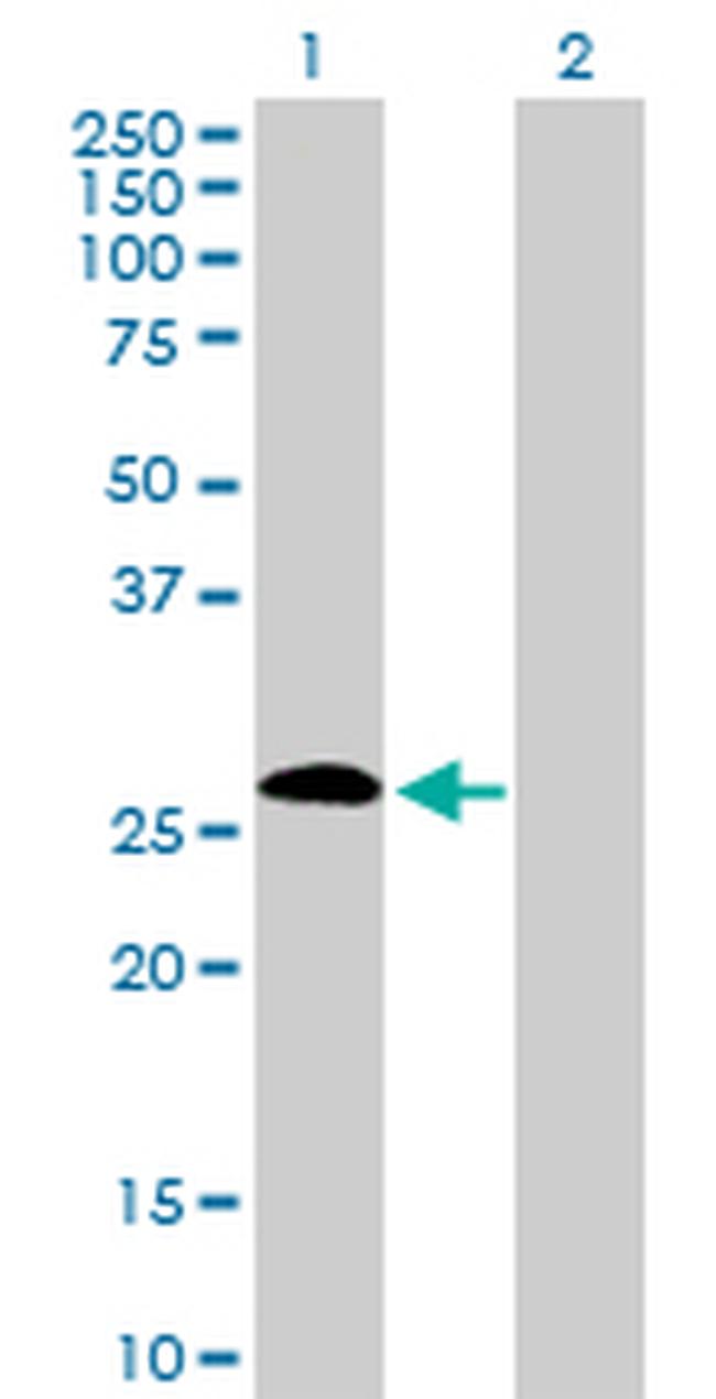 IGSF6 Antibody in Western Blot (WB)