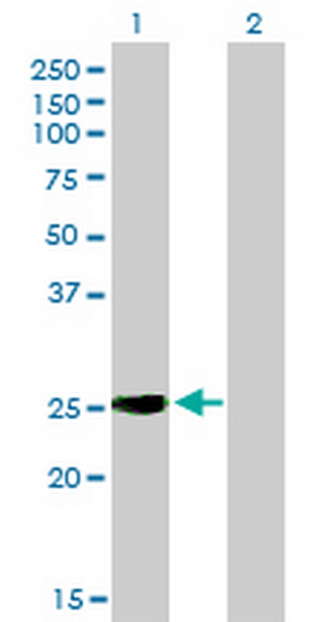 IGSF6 Antibody in Western Blot (WB)