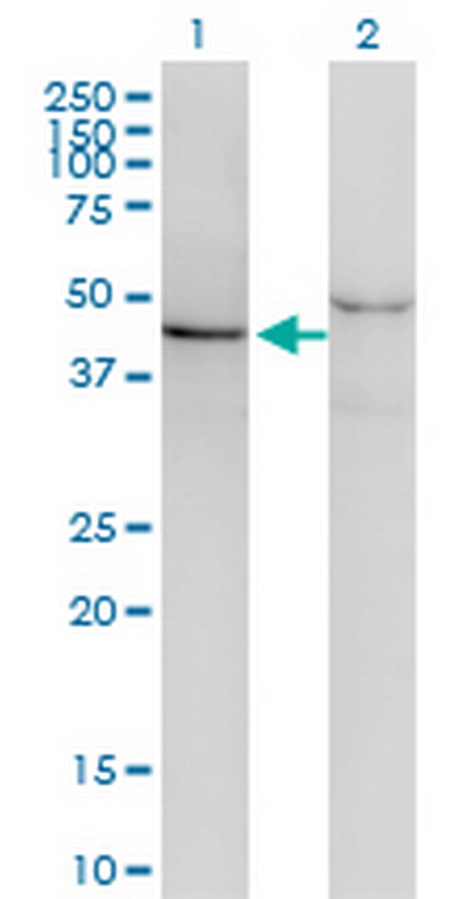 SF3B4 Antibody in Western Blot (WB)