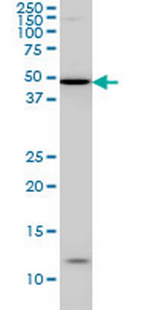 IRX5 Antibody in Western Blot (WB)