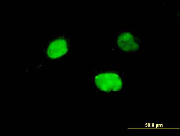 IRX5 Antibody in Immunocytochemistry (ICC/IF)