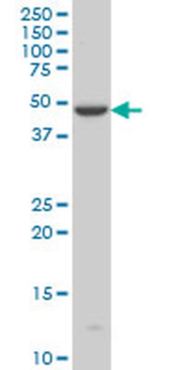 IRX5 Antibody in Western Blot (WB)