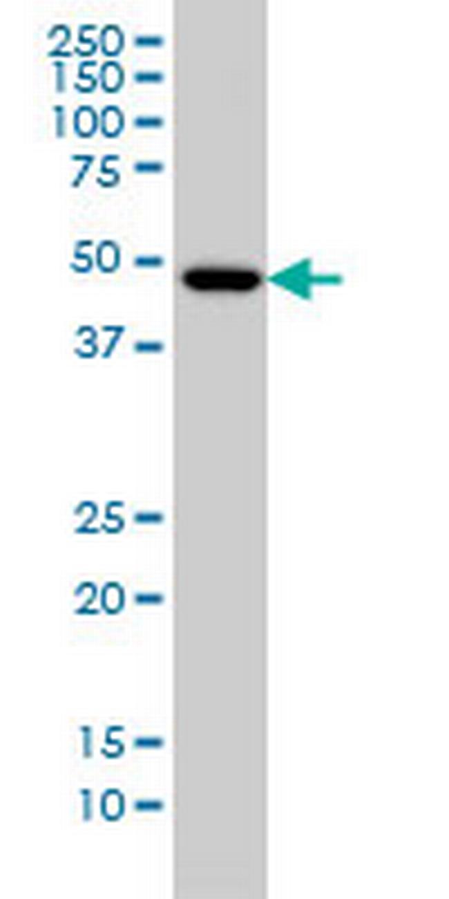 IRX5 Antibody in Western Blot (WB)