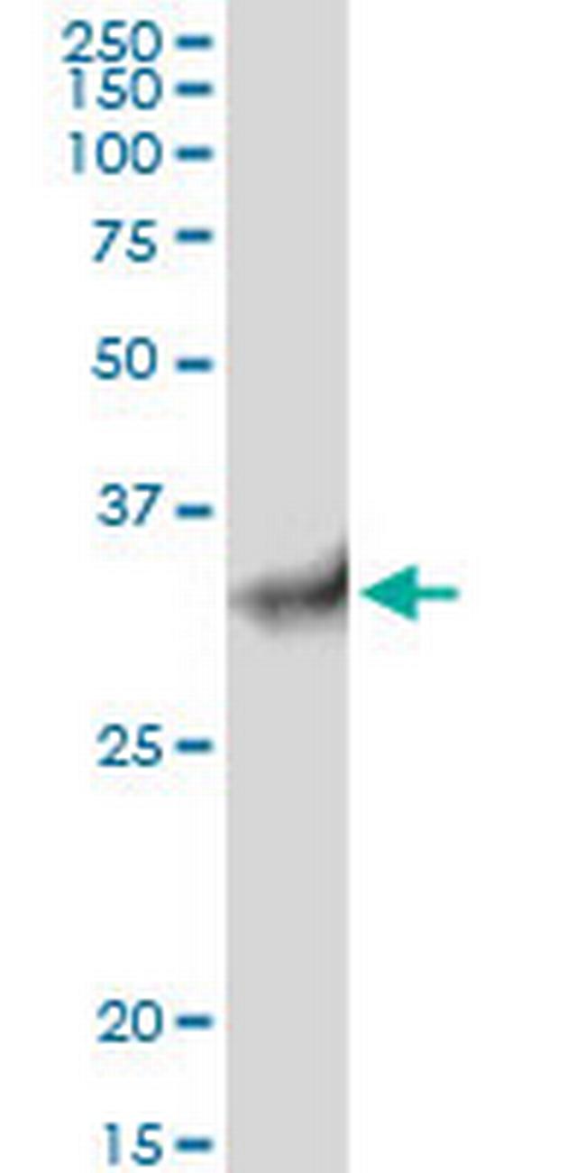 STUB1 Antibody in Western Blot (WB)