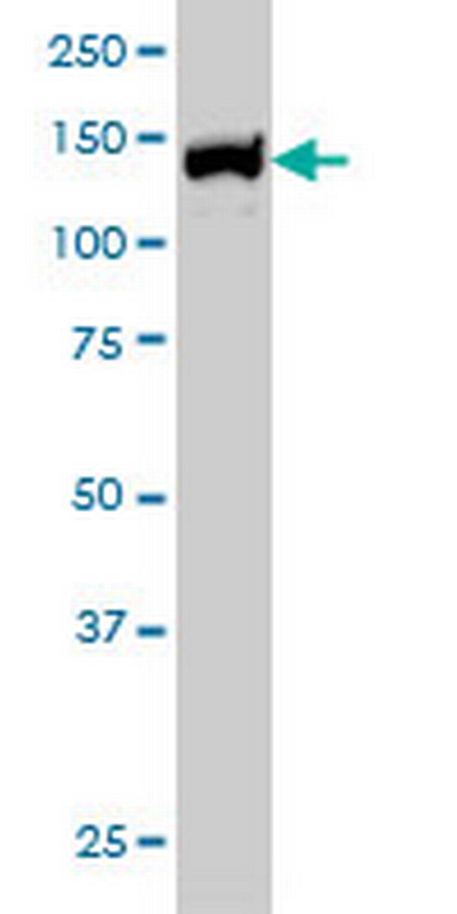 UBE4B Antibody in Western Blot (WB)