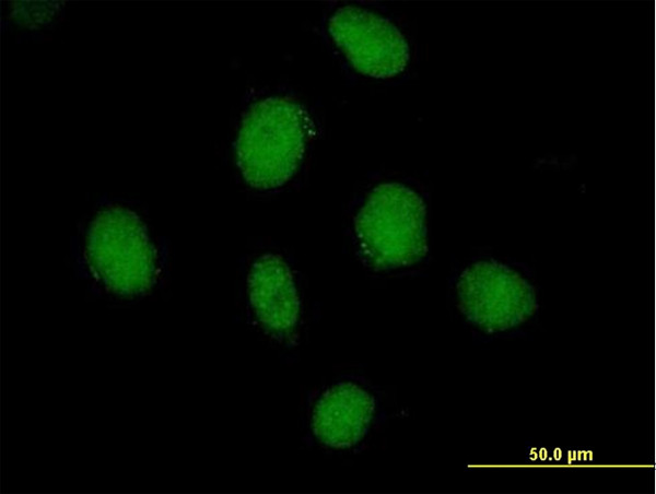 SDCCAG10 Antibody in Immunocytochemistry (ICC/IF)