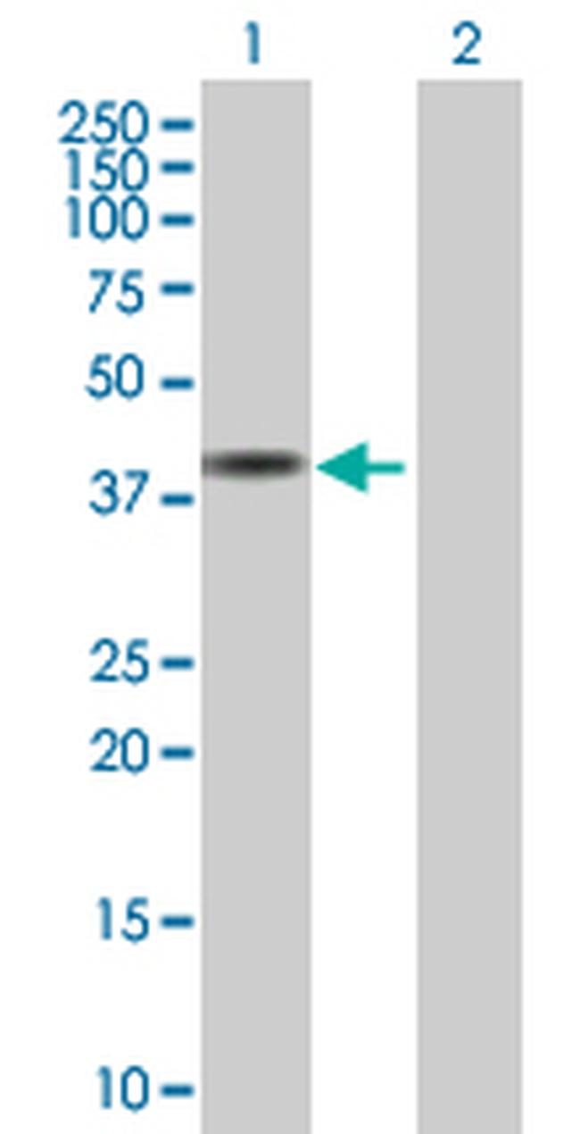 SDCCAG10 Antibody in Western Blot (WB)