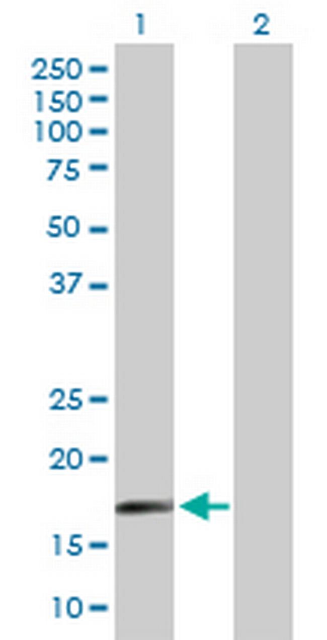 SAP18 Antibody in Western Blot (WB)