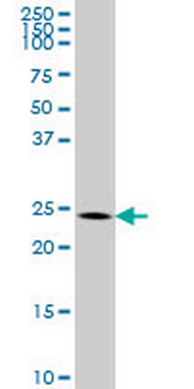 BCAS2 Antibody in Western Blot (WB)