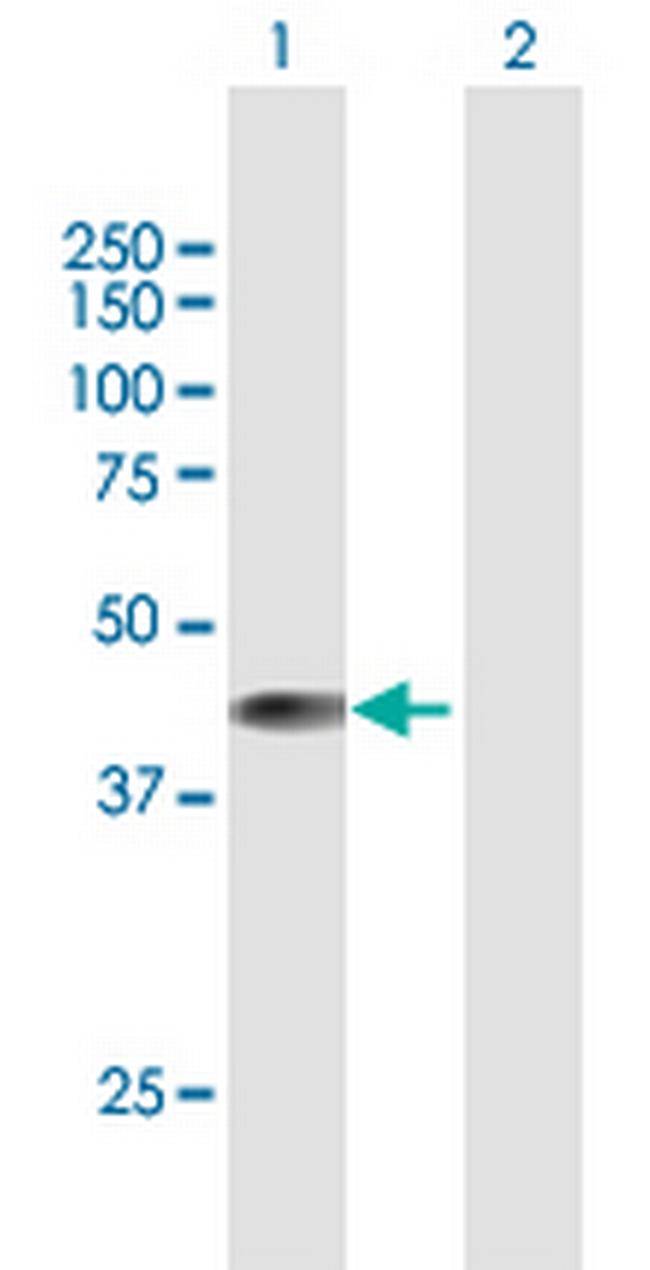 BCKDK Antibody in Western Blot (WB)