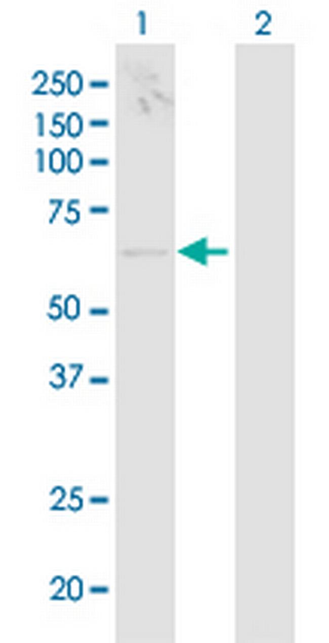 TCIRG1 Antibody in Western Blot (WB)