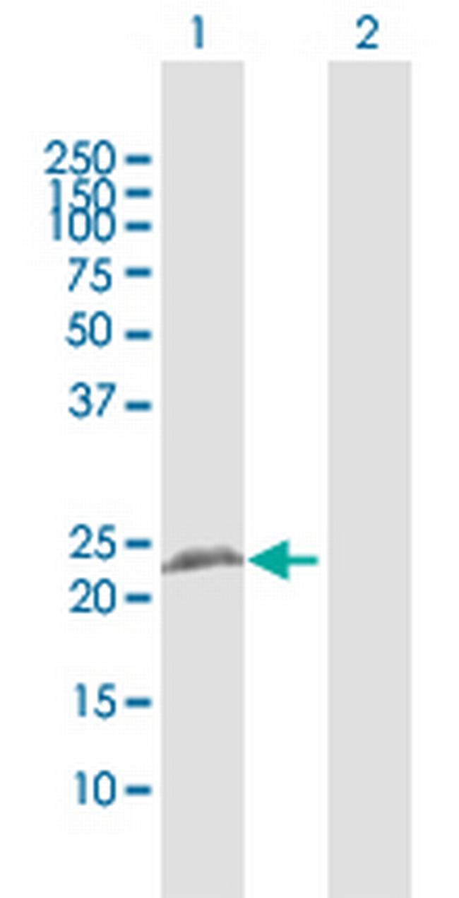 RTN3 Antibody in Western Blot (WB)