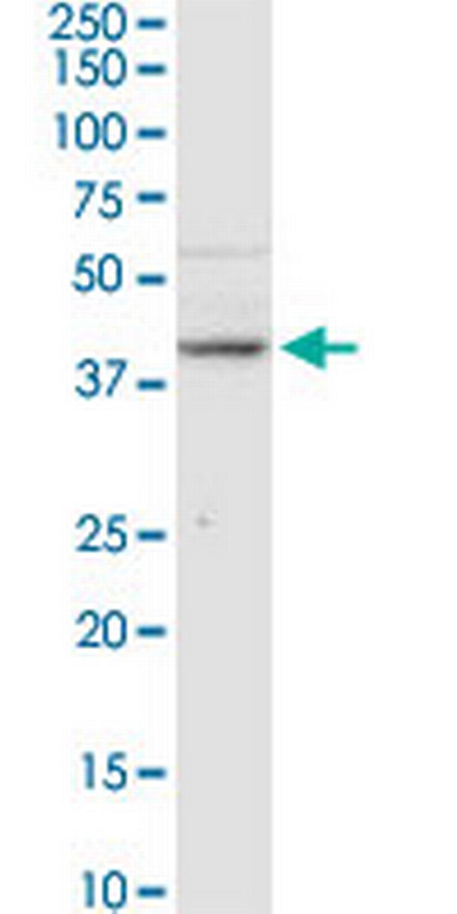 B3GNT3 Antibody in Western Blot (WB)