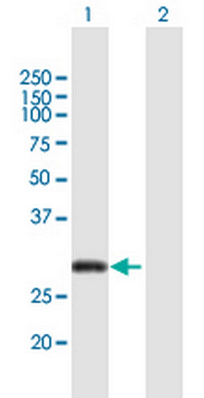 CITED2 Antibody in Western Blot (WB)