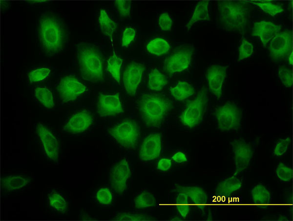 TUBB4B Antibody in Immunocytochemistry (ICC/IF)