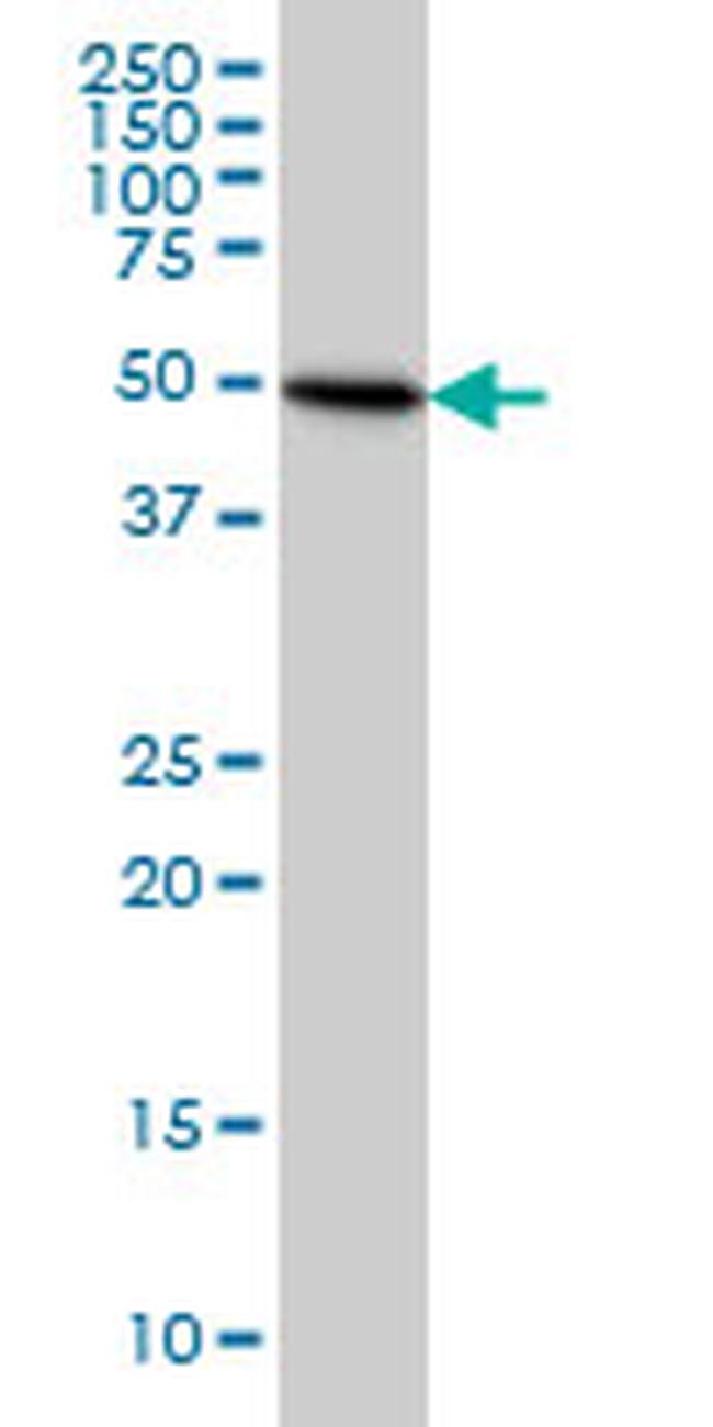 TUBB4B Antibody in Western Blot (WB)