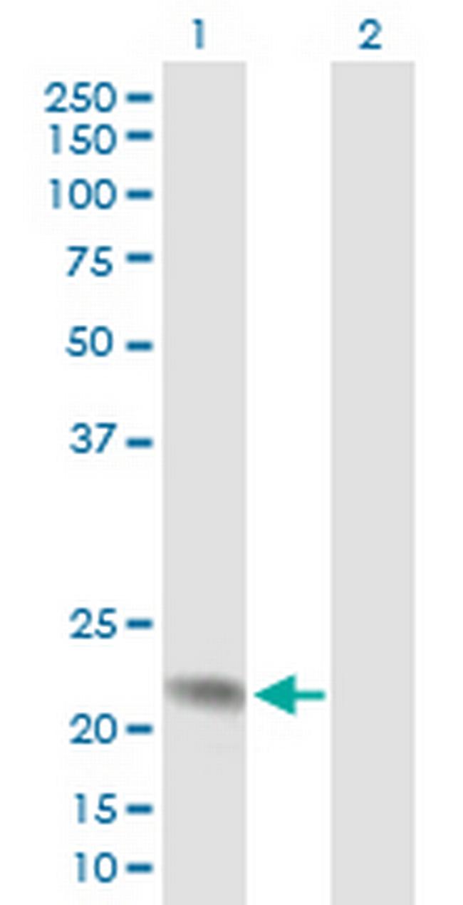 ANAPC10 Antibody in Western Blot (WB)