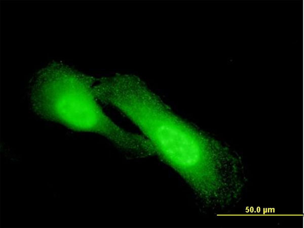 NDRG1 Antibody in Immunocytochemistry (ICC/IF)