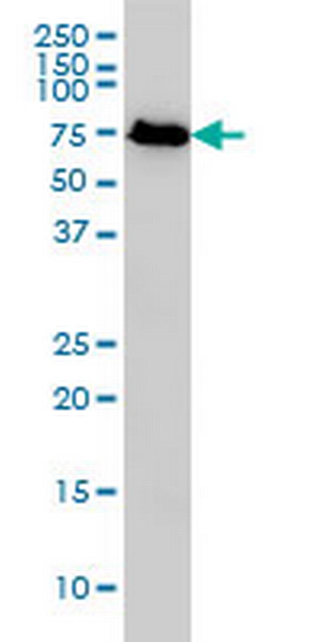 KNTC2 Antibody in Western Blot (WB)